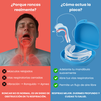 Placa Anti Ronquidos y Bruxismo – Duerme Mejor, Despierta con Energía
